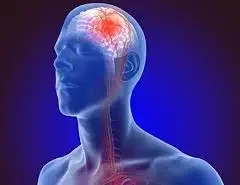 Stroke & Ventilator Recovery