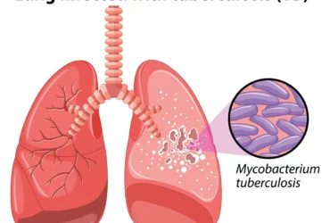 lung-with-tuberculosis lung-with-tuberculosis