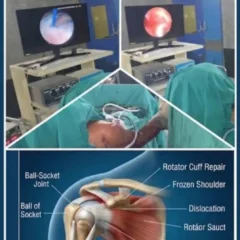 ADVANCED SHOULDER CARE AT BALANKU HOSPITAL, RAICHUR
