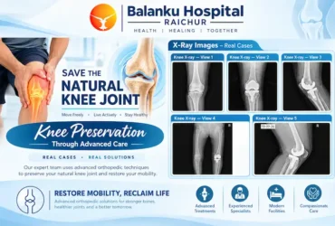 Save Your Natural Knee Joint – HTO Surgery Save Your Natural Knee Joint – HTO Surgery